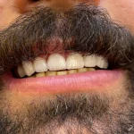 نمونه کار (13)