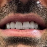 نمونه کار (2)